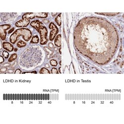 LDHD Antibody, Novus Biologicals 0.1mL; Unlabeled:Antibodies, Polyclonal
